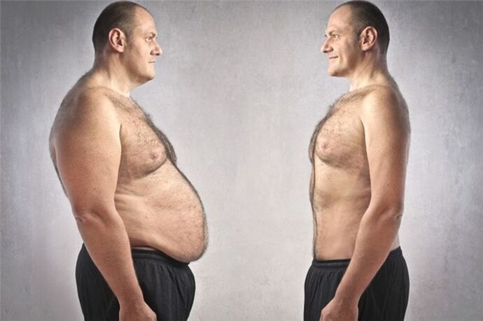 prekomjerna tjelesna težina i prostatitis