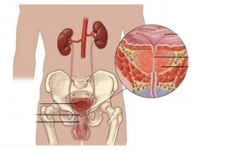 prostatitis kod muškaraca