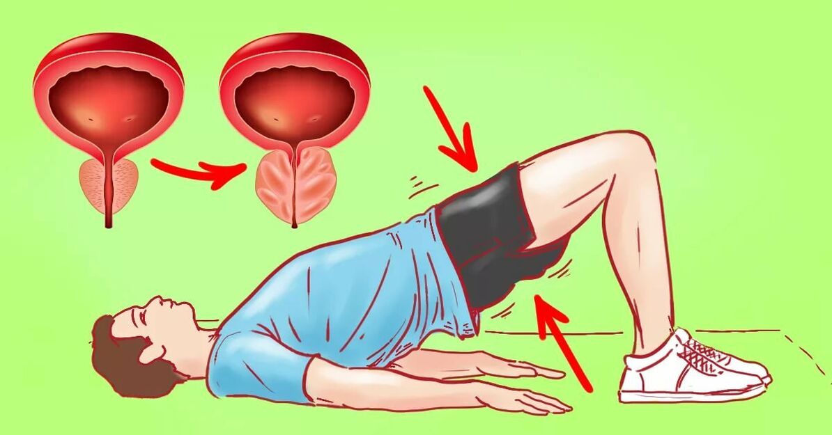 Vježbe za prostatitis